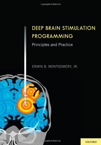 Deep Brain Stimulation Programming