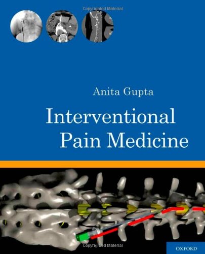 Interventional Pain Medicine