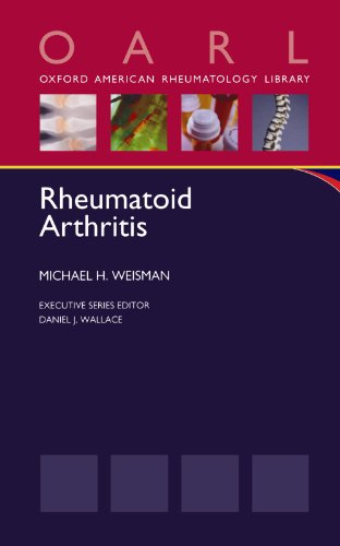 Rheumatoid Arthritis