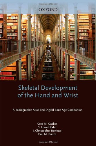 Skeletal Development of the Hand and Wrist
