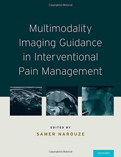 Multimodality imaging guidance in interventional pain management