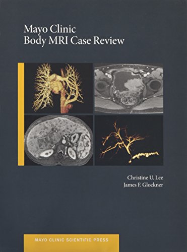 Mayo Clinic Body MRI Case Review