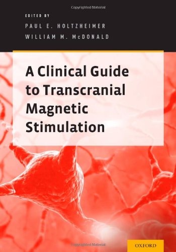 Clinical Guide to the Administration of Transcranial Magnetic Stimulation for Neuropsychiatric Disorders