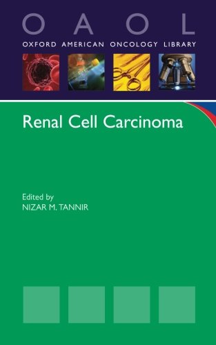 Renal Cell Carcinoma