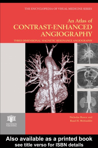 Atlas Of Contrast Enhanced Angiography