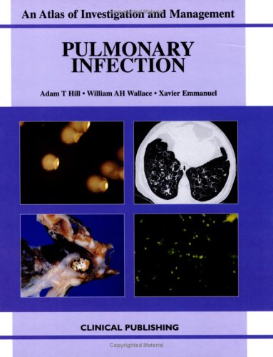 Pulmonary Infection