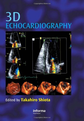 3D Echocardiography