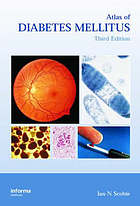 Atlas of Diabetes Mellitus