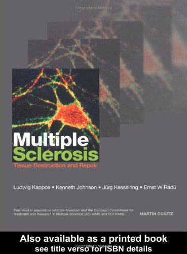 Multiple Sclerosis