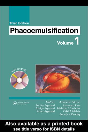 Phacoemulsification