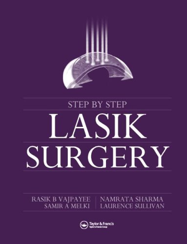 Step by Step Lasik Surgery