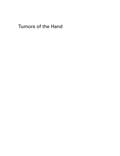 Tumors of the Hand