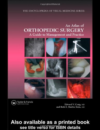 Atlas of Orthopedic Surgery