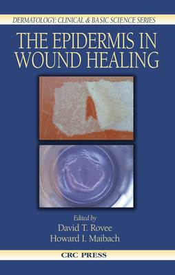 The Epidermis in Wound Healing