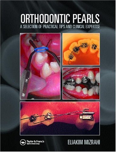 Orthodontic Pearls: A Selection of Practical Tips and Clinical Expertise