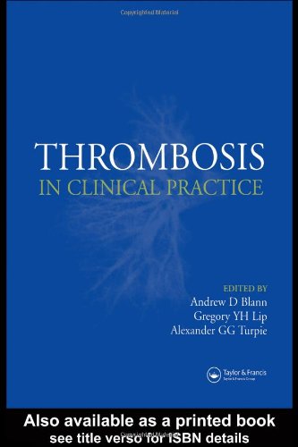 Thrombosis in Clinical Practice