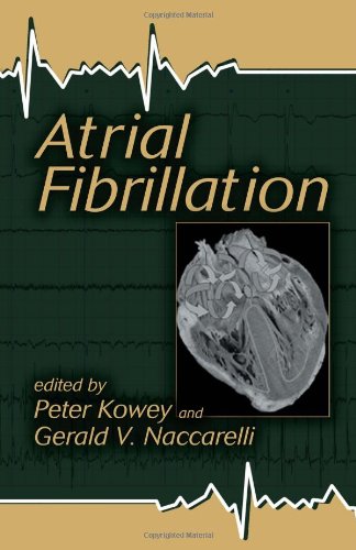 Atrial Fibrillation