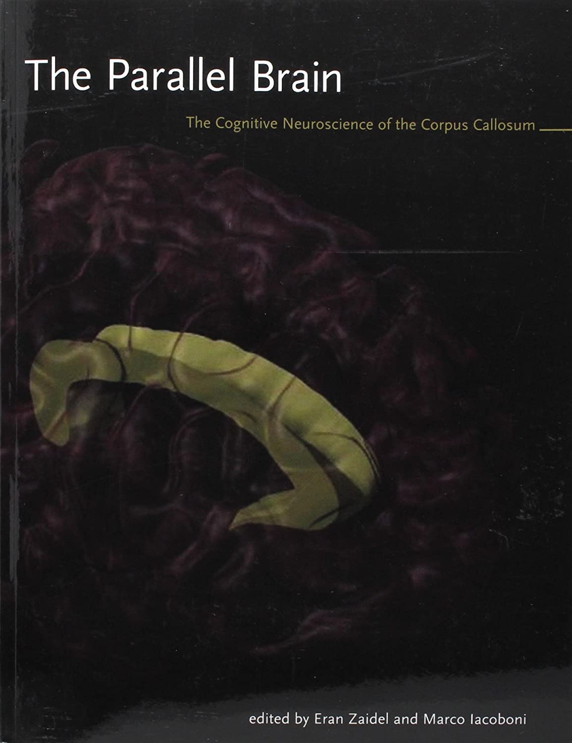 The Parallel Brain: The Cognitive Neuroscience of the Corpus Callosum (Issues in Clinical and Cognitive Neuropsychology)