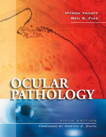 Ocular Pathology