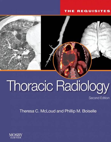 Thoracic Radiology: The Requisites (Requisites in Radiology)