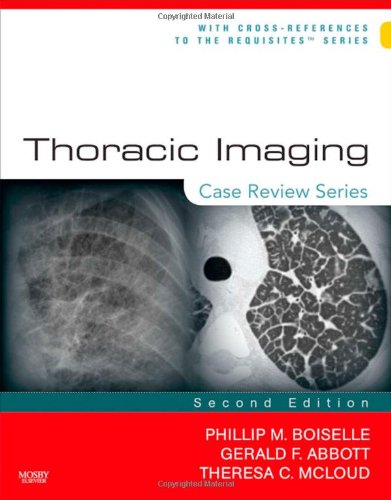 Thoracic Imaging: Case Review Series