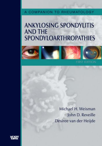 Ankylosing Spondylitis and the Spondyloarthropathies