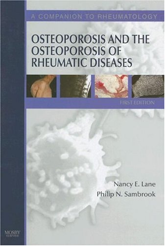 Osteoporosis and the Osteoporosis of Rheumatic Diseases