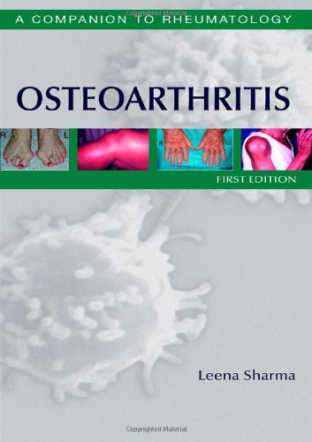 Osteoarthritis