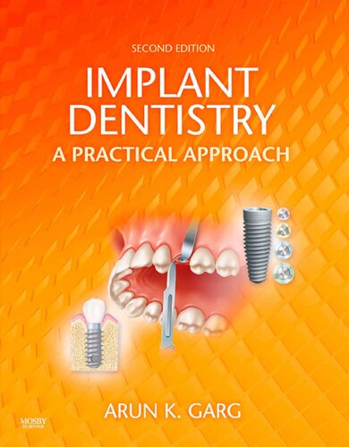 Implant Dentistry