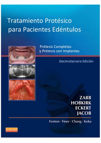 Prosthodontic Treatment for Edentulous Patients