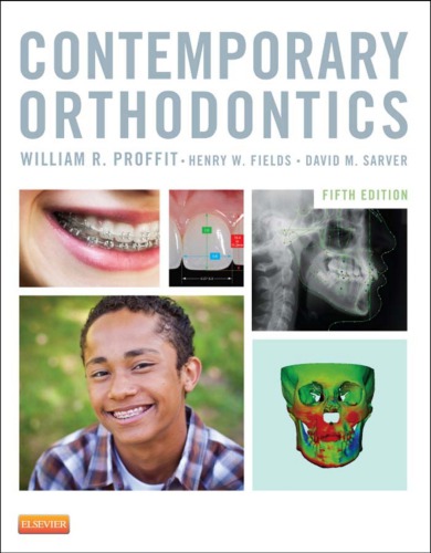 Contemporary Orthodontics