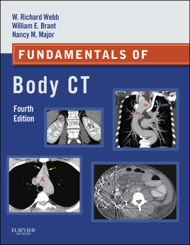 Fundamentals of Body CT E-Book
