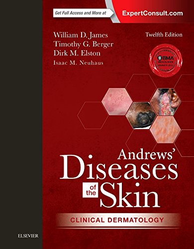 Andrews' Diseases of the Skin