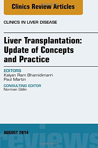 Liver Transplantation