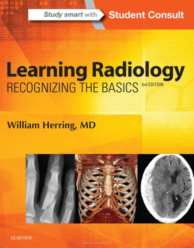 Learning Radiology