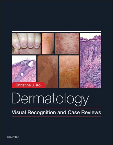 Dermatology: Visual Recognition and Case Reviews