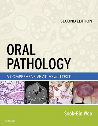 Oral Pathology