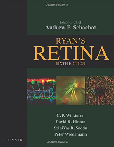 Ryan's Retina