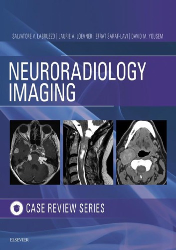 Neuroradiology Imaging Case Review