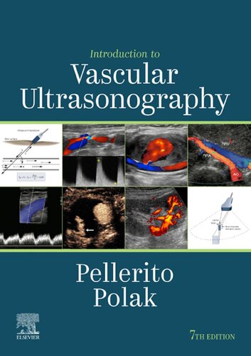 Introduction to Vascular Ultrasonography