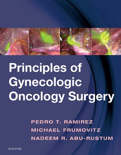 Principles of gynecologic oncology surgery