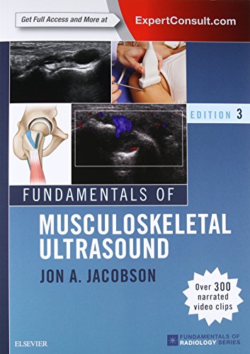 Fundamentals of Musculoskeletal Ultrasound