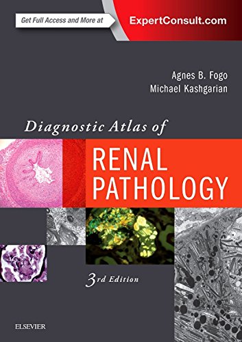 Diagnostic Atlas of Renal Pathology E-Book