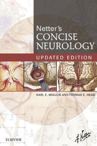 Netter's Concise Neurology