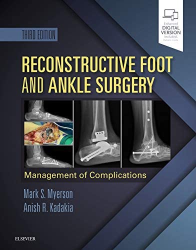 Reconstructive Foot and Ankle Surgery: Management of Complications: Expert Consult - Online, Print, and DVD