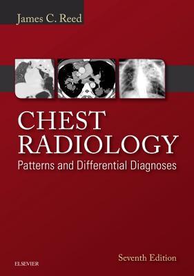 Chest Radiology