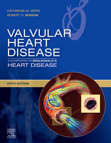 Valvular Heart Disease