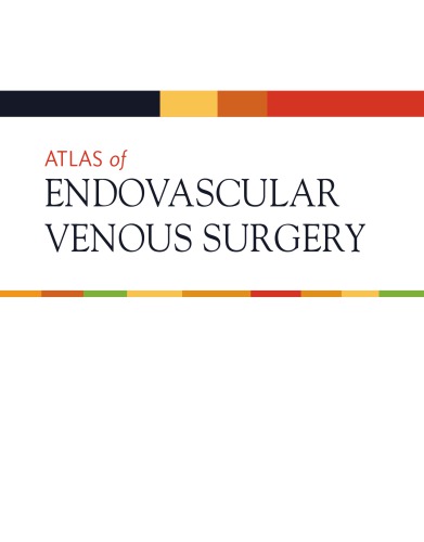 Atlas of Endovascular Venous Surgery E-Book