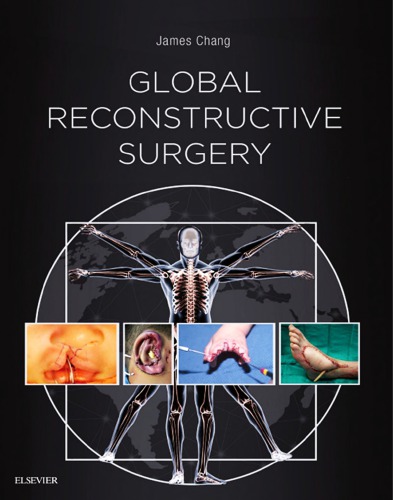 Global Reconstructive Surgery