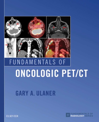 Fundamentals of oncologic PET/CT